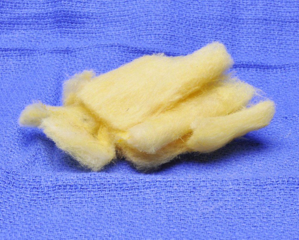 kearfottk600a37401_isap_rlg_block_insulation1.jpg